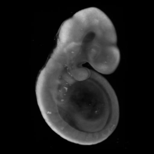 3D computer representation of a theiler stage 15 mouse embryo in situ hybridized with a frizzled 3 probe