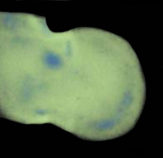 3D computer representation of frizzled 4 expression in the theiler stage 19 forelimb