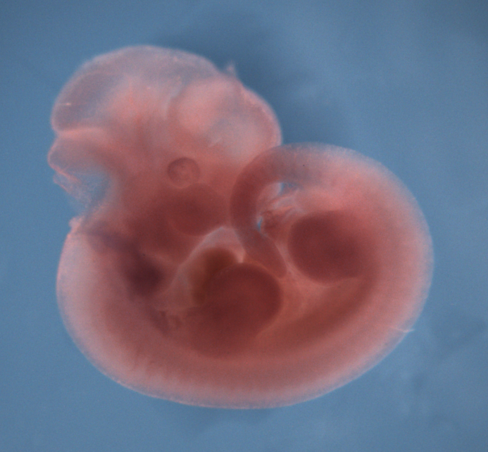photo of a theiler stage 19 mouse embryo in situ hybridized with a frizzled 4 probe