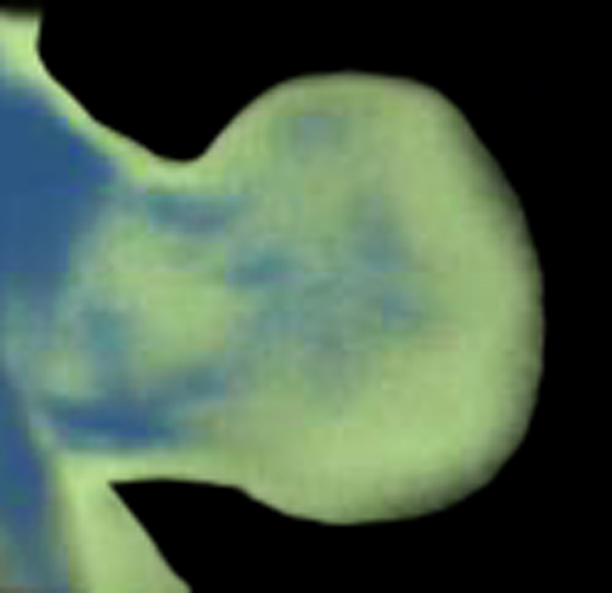 3D computer representation of a theiler stage 19 forelimb in situ hybridized with a frizzled 7 probe