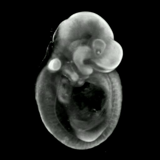 3D computer representation of a theiler stage 15 mouse embryo in situ hybridized with a frizzled 8 probe