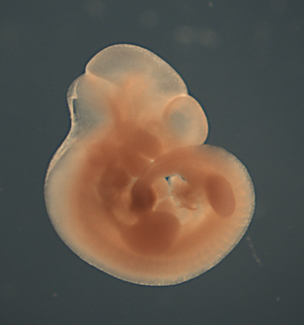 photo of a theiler stage 17 mouse embryo in situ hybridized with a  frizzled 9 probe