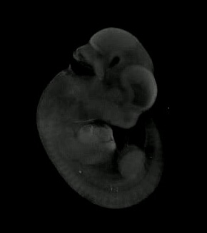 3D computer representation of a mouse embryo in situ hybridized with a Wnt 10A probe