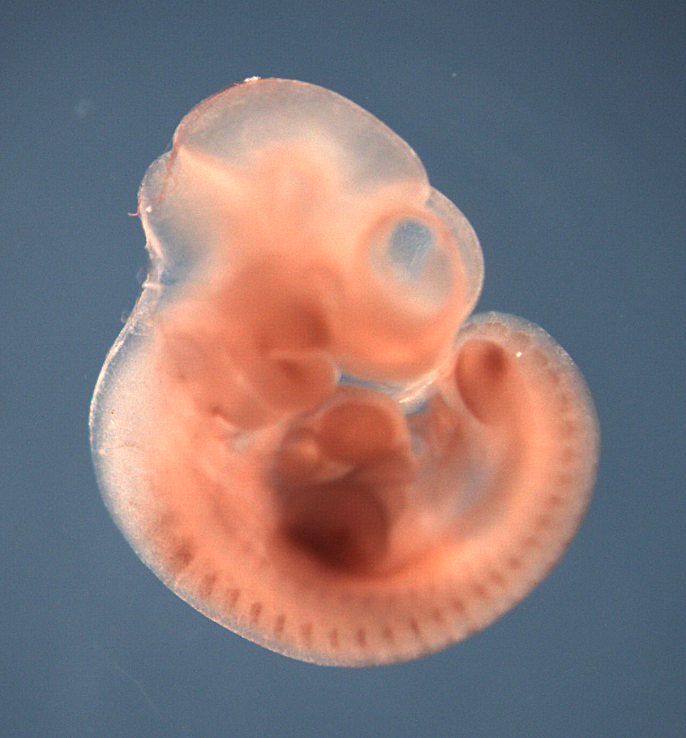 photo of a theiler stage 17 mouse embryo in situ hybridized with a wnt 11 probe
