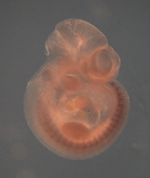 photo of a theiler stage 17 mouse embryo in situ hybridized with a wnt 16 probe