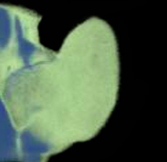 3D computer representation of a theiler stage 19 mouse forelimb in situ hybridized with a wnt 2 probe