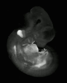 3d computer reconstruction of a mouse embryo in situ hybridized with a wnt 2 probe