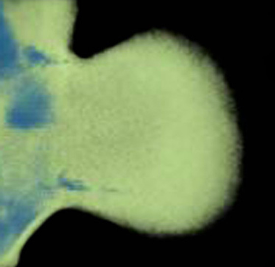 3D computer representation of a thieler stage 19 mouse forelimb in situ hybridized with a wnt 4 probe