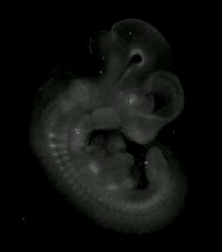 3d computer reconstruction of a mouse embryo in situ hybridized with a wnt 5b probe