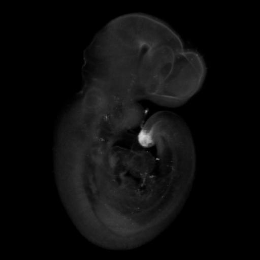3D computer representation of a theiler stage 15 mouse embryo in situ hybridized with a wnt 5b probe