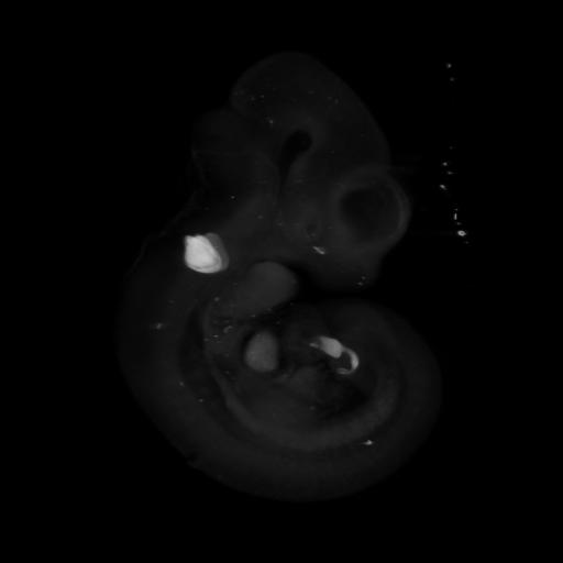 3D computer representation of a theiler stage 17 mouse embryo in situ hybridized with a wnt 8a probe