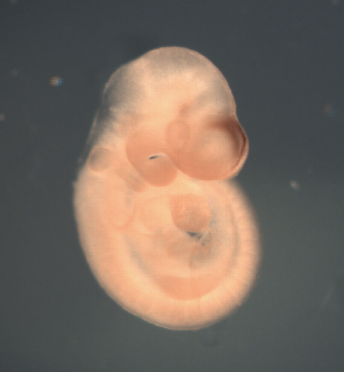 photo of a theiler stage 15 mouse embryo in situ hybridized with a wnt 8b probe