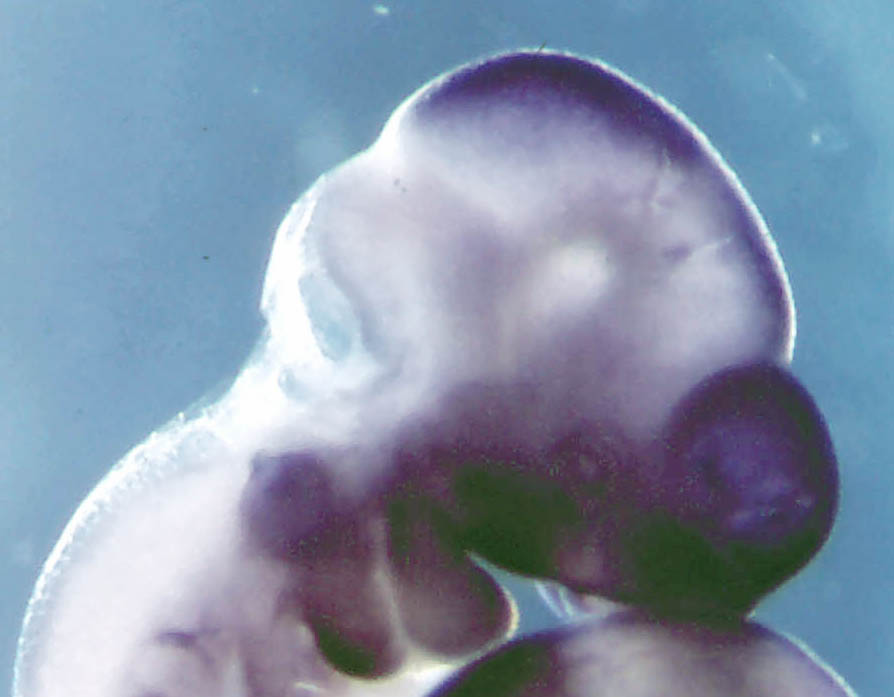 photo of an e10.5 mouse embryo in situ hybridized with a ß-Catenin probe