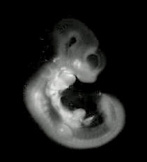 3D computer representation of an e10.5 mouse embryo in situ hybridized with a ß-Catenin probe