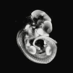 3D computer reconstruction of an e9.5 mouse embryo in situ hybridized with a lef1 probe