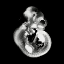 3D computer representation of an e10.5 mouse embryo in situ hybridized with a tcf1 probe