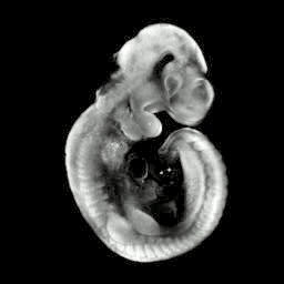 3D computer representation of an e9.5 mouse embryo in situ hybridized with a tcf3 probe