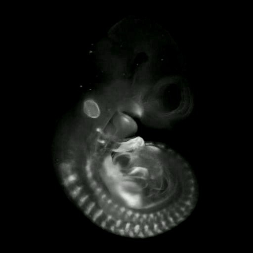 3D computer representation of a theiler stage 17 mouse embryo in situ hybridized with a wnt 16 probe