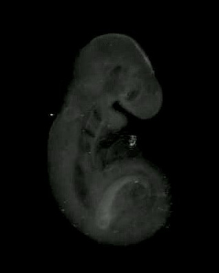 3D computer representation of a theiler stage 15 mouse embryo in situ hybridized with a wnt 2b probe