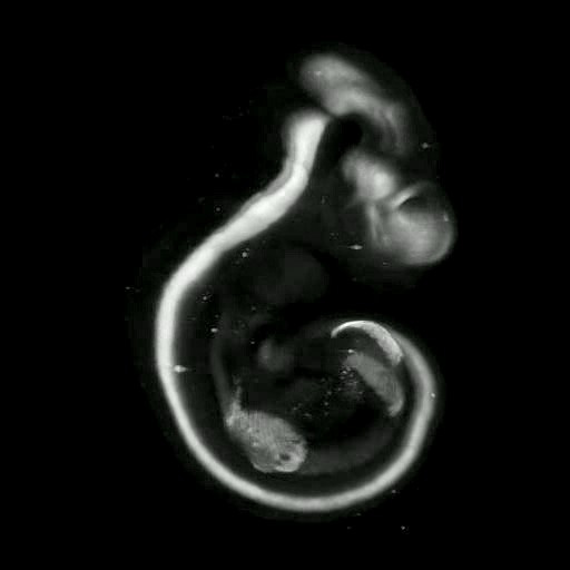3D computer representation of a theiler stage 17 mouse embryo in situ hybridized with a wnt 7a probe